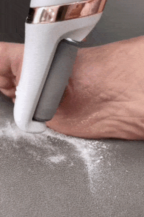 Electric Pedicure Foot File Callus Remover